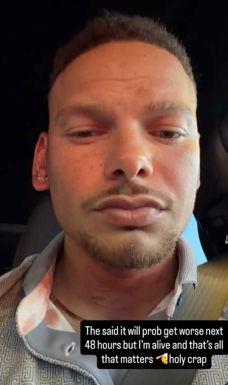 Kane Brown hit in head by golf ball